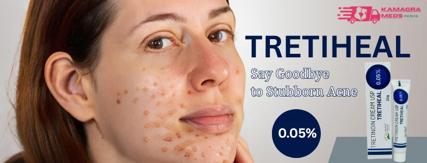 What is tretinoin cream​ and where can i buy tretinoin cream uk​
