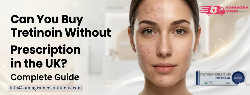 Can I Buy Tretinoin Without a Prescription in the UK